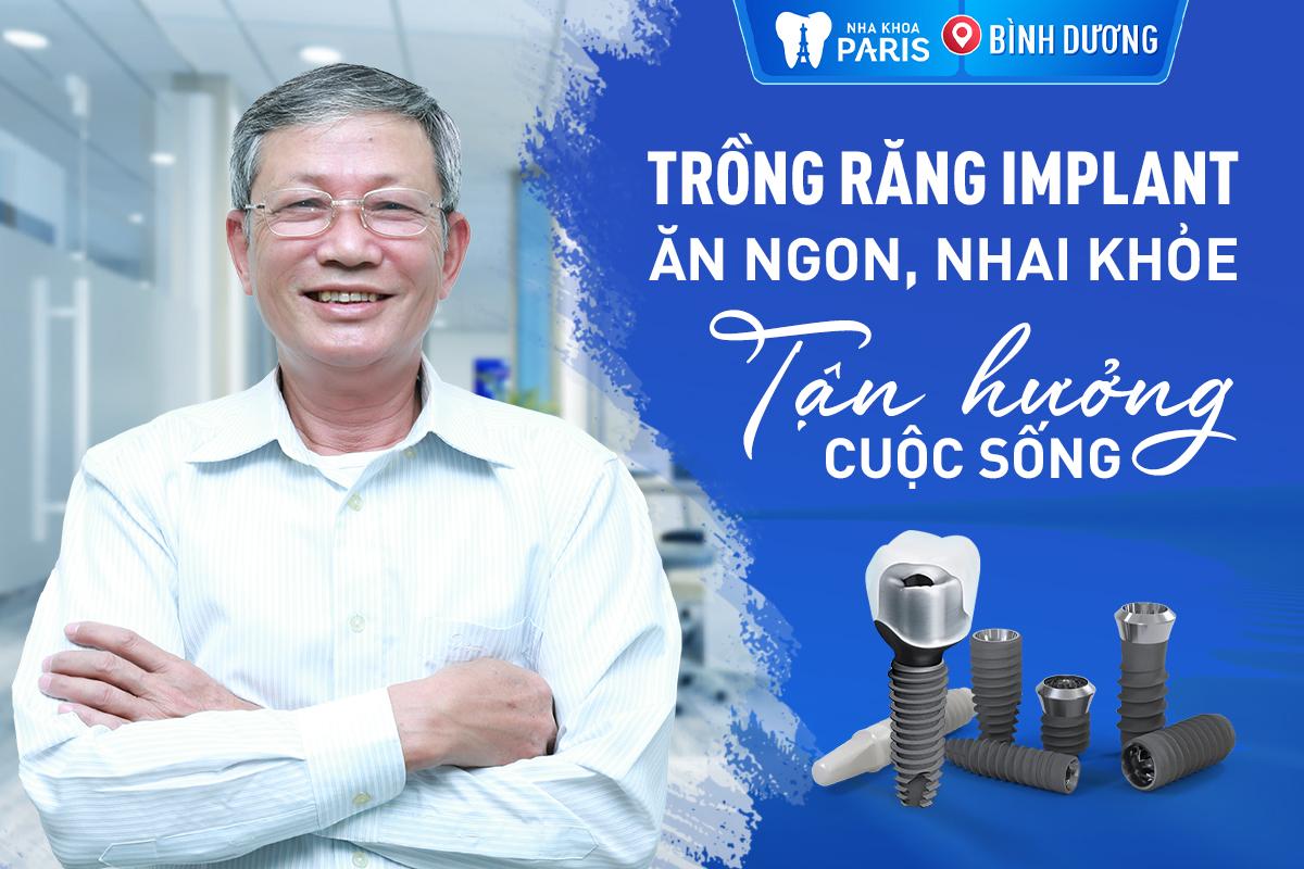 Top 9 địa chỉ trồng răng implant chất lượng nhất tại Thủ Dầu Một, Bình Dương