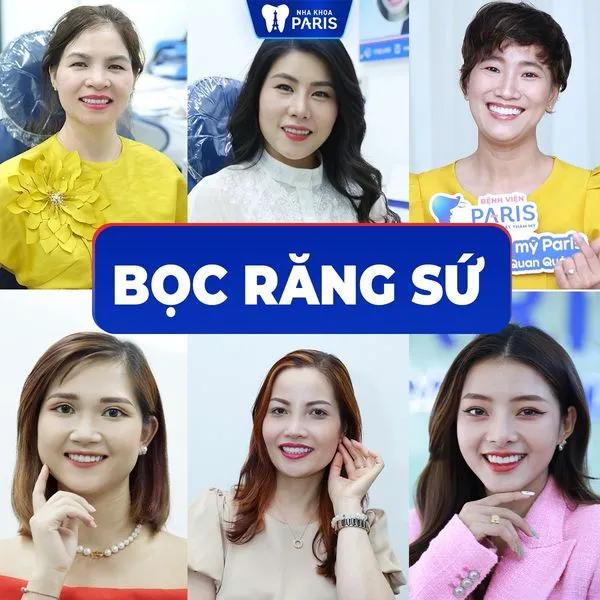 9 Địa điểm bọc răng sứ chất lượng và uy tín nhất Thủ Dầu Một, Bình Dương