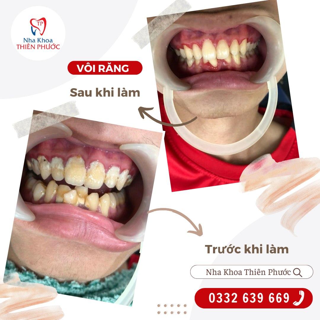 Top 3 địa chỉ phòng khám nha khoa đáng tin cậy và chất lượng hàng đầu tại huyện Tịnh Biên, An Giang