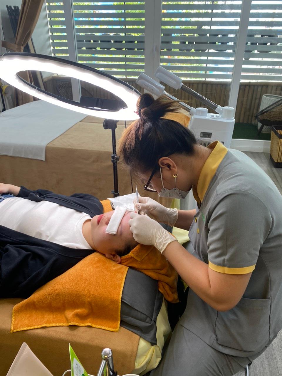 6 Địa chỉ điều trị sẹo rỗ/sẹo mụn chất lượng nhất Vũng Tàu