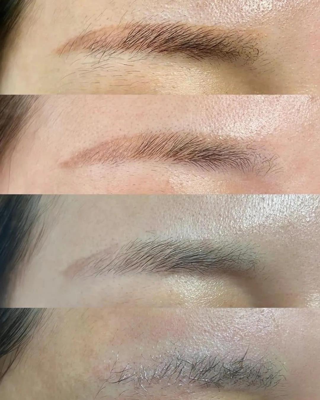 Top 5 địa chỉ xóa xăm chân mày hiệu quả nhất tại Cần Thơ