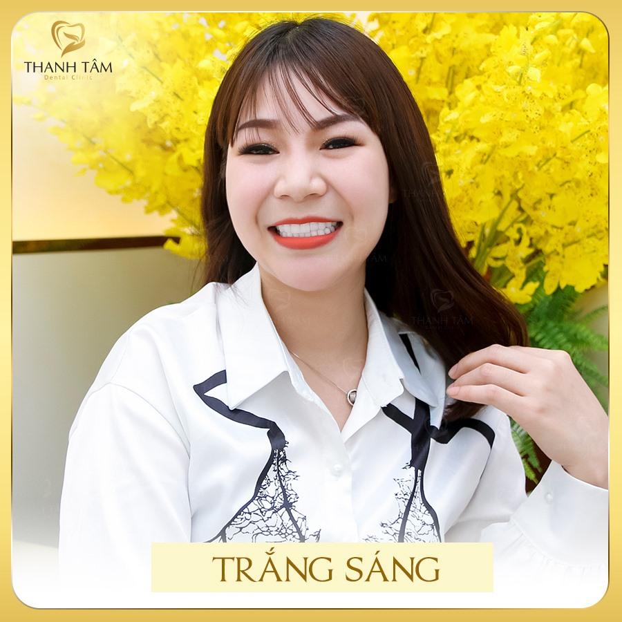 Top 10 địa chỉ bọc răng sứ chất lượng, uy tín hàng đầu tại TP.HCM