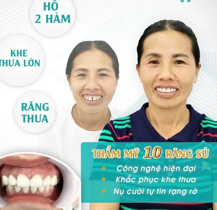 6 địa chỉ phòng khám nha khoa đáng tin cậy bậc nhất tại Cà Mau