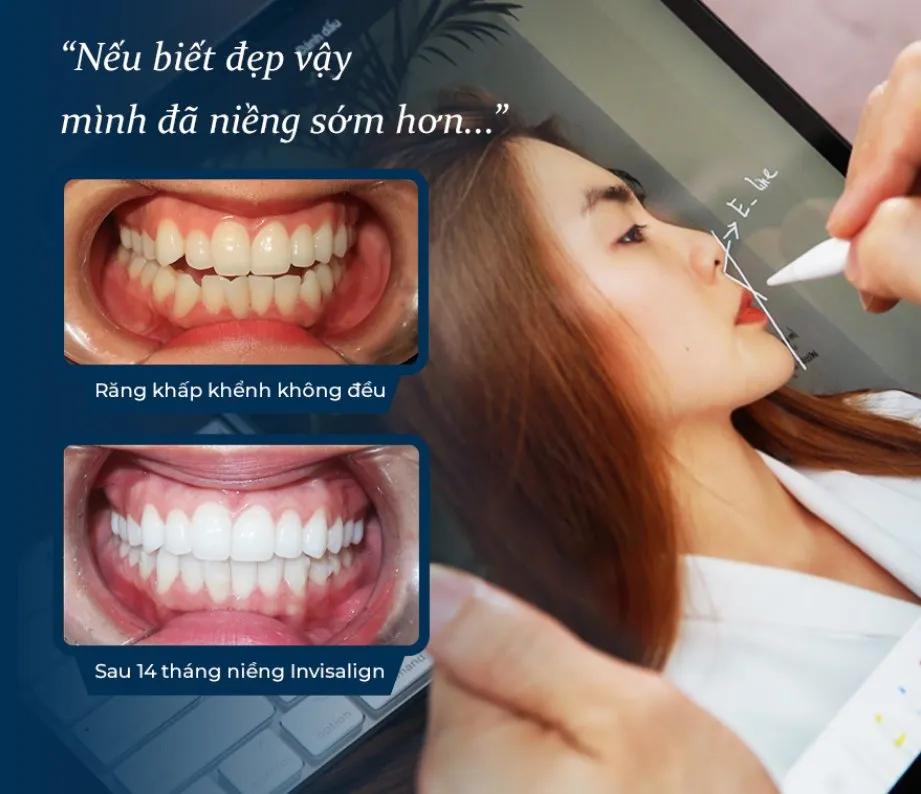 Top 5 địa chỉ nha khoa đáng tin cậy nhất tại quận 12, TP. Hồ Chí Minh