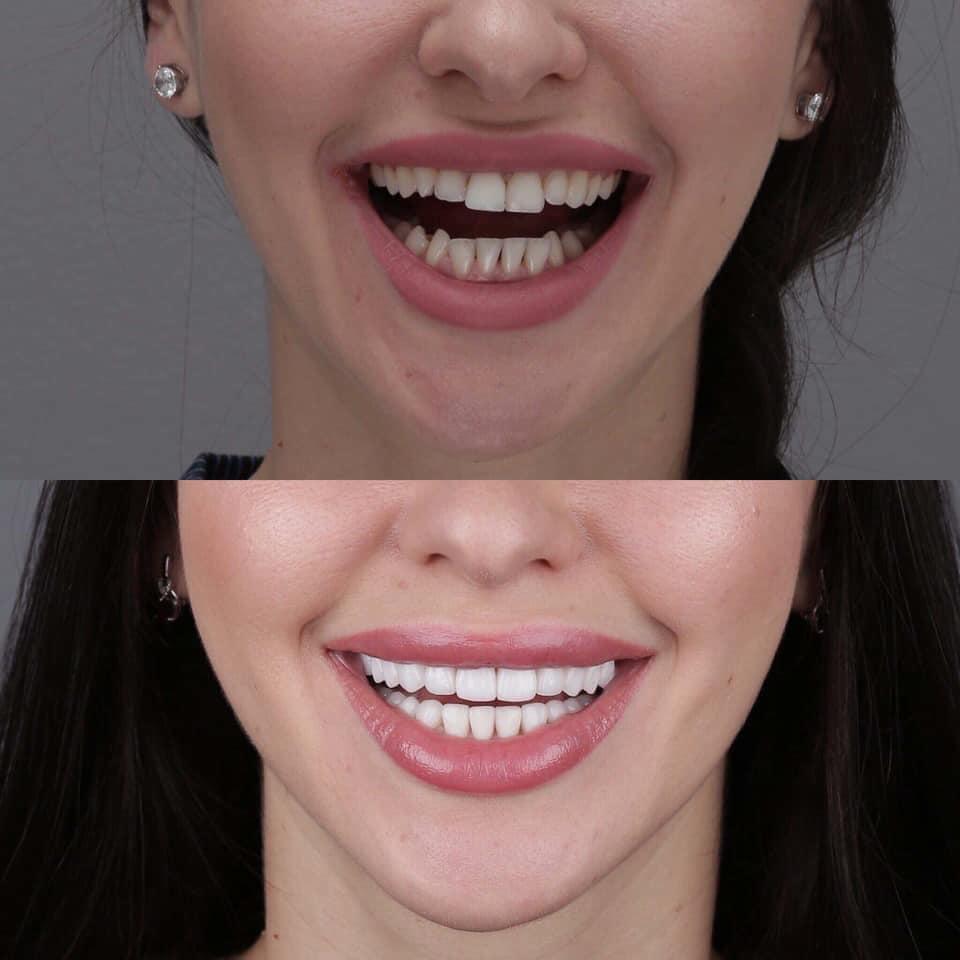 Top 3 địa chỉ phòng khám nha khoa đáng tin cậy và chất lượng nhất tại TP. Cam Ranh, Khánh Hòa