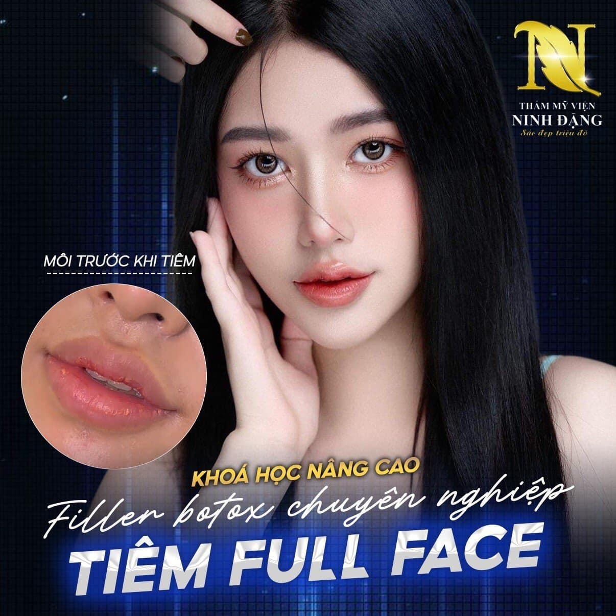 Top 5 địa chỉ tiêm môi uy tín và đẹp nhất tại Hải Phòng