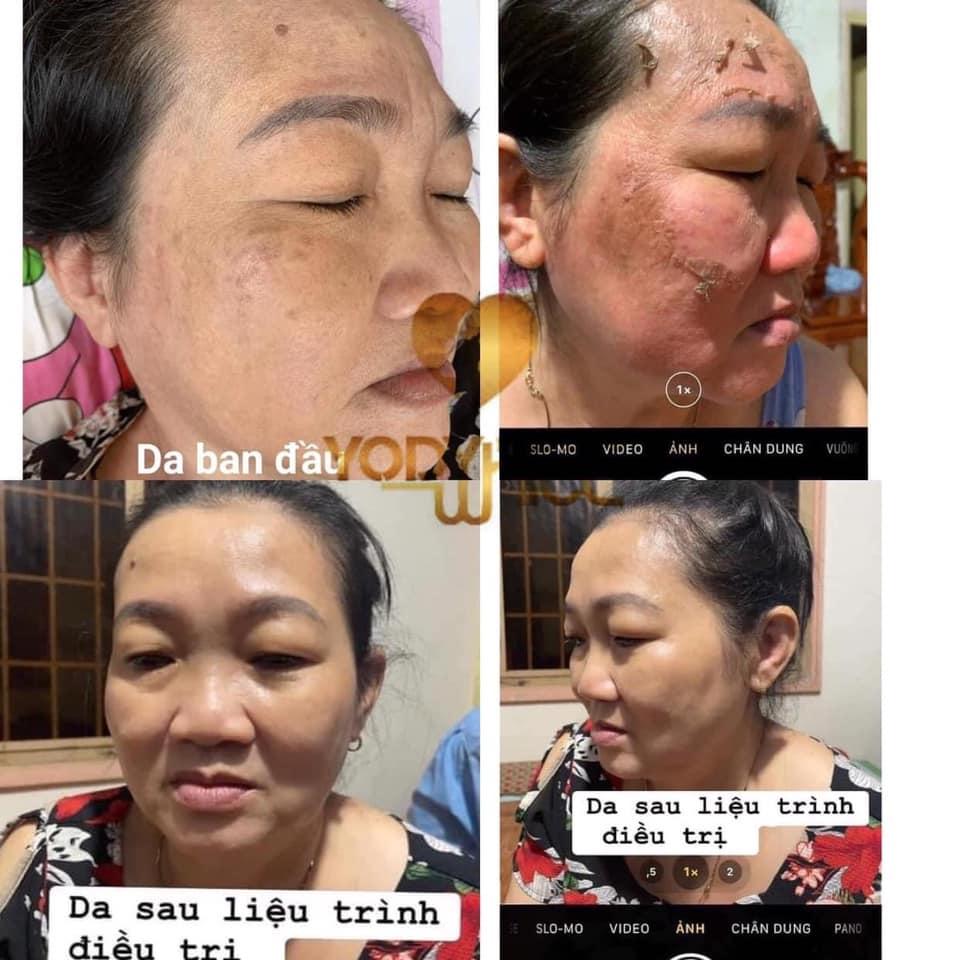 Top 5 địa chỉ uy tín tại Châu Đức, Bà Rịa - Vũng Tàu chuyên trị nám, tàn nhang và làm trẻ hóa làn da