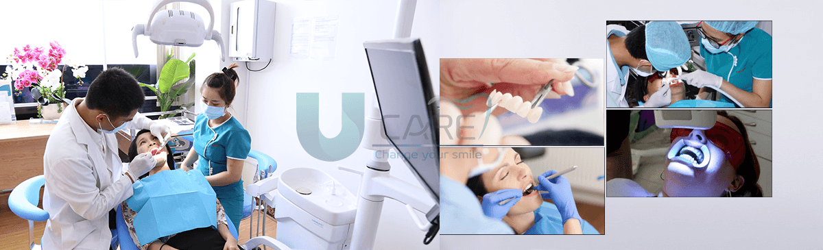 8 địa chỉ vàng điều trị viêm nha chu đáng tin cậy nhất tại TP.HCM