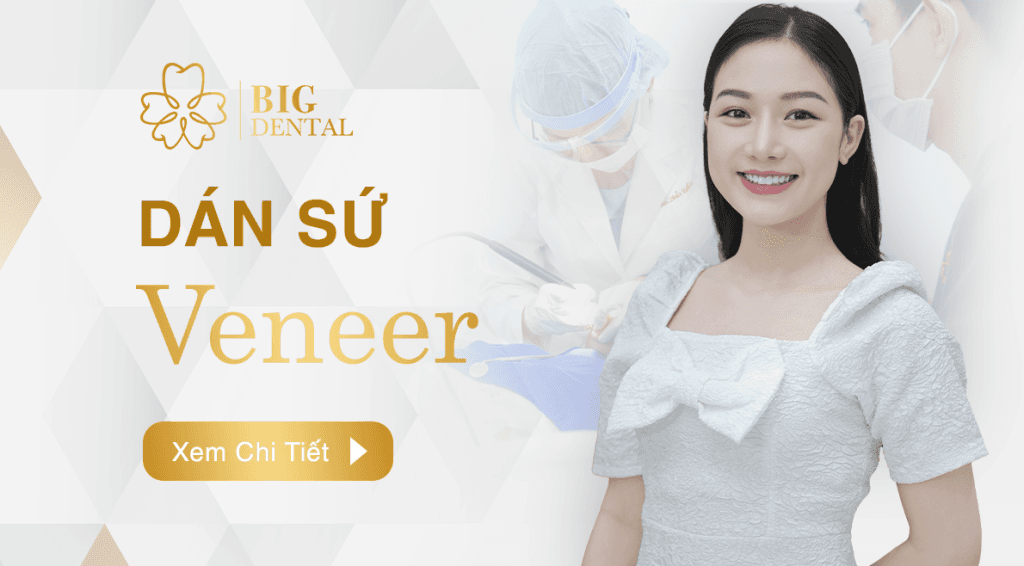 6 Địa chỉ nha khoa dán sứ veneer chất lượng hàng đầu tại Gia Lai