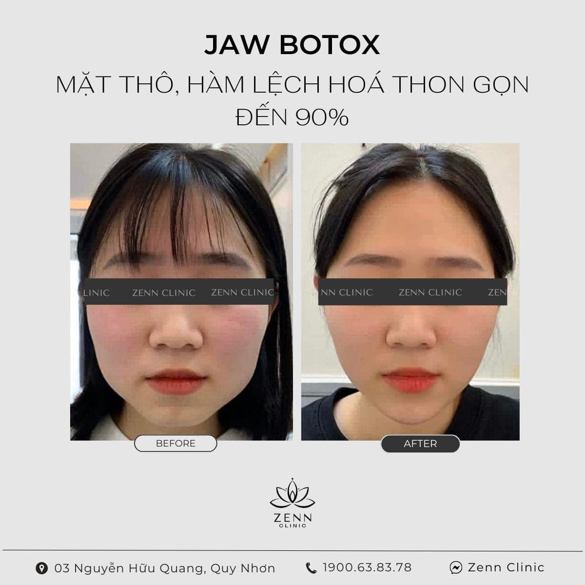 Top 9 Địa chỉ Spa làm đẹp đáng trải nghiệm nhất tại Quy Nhơn, Bình Định
