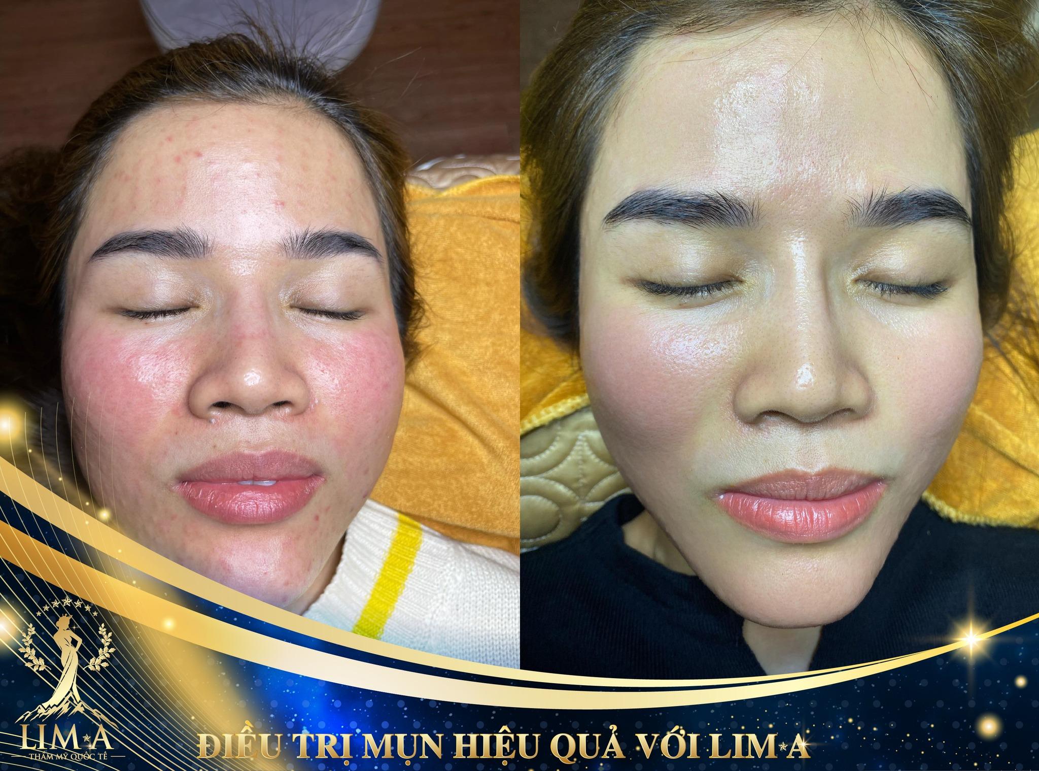 5 Phòng khám da liễu uy tín nhất tại Bà Rịa - Vũng Tàu không nên bỏ qua