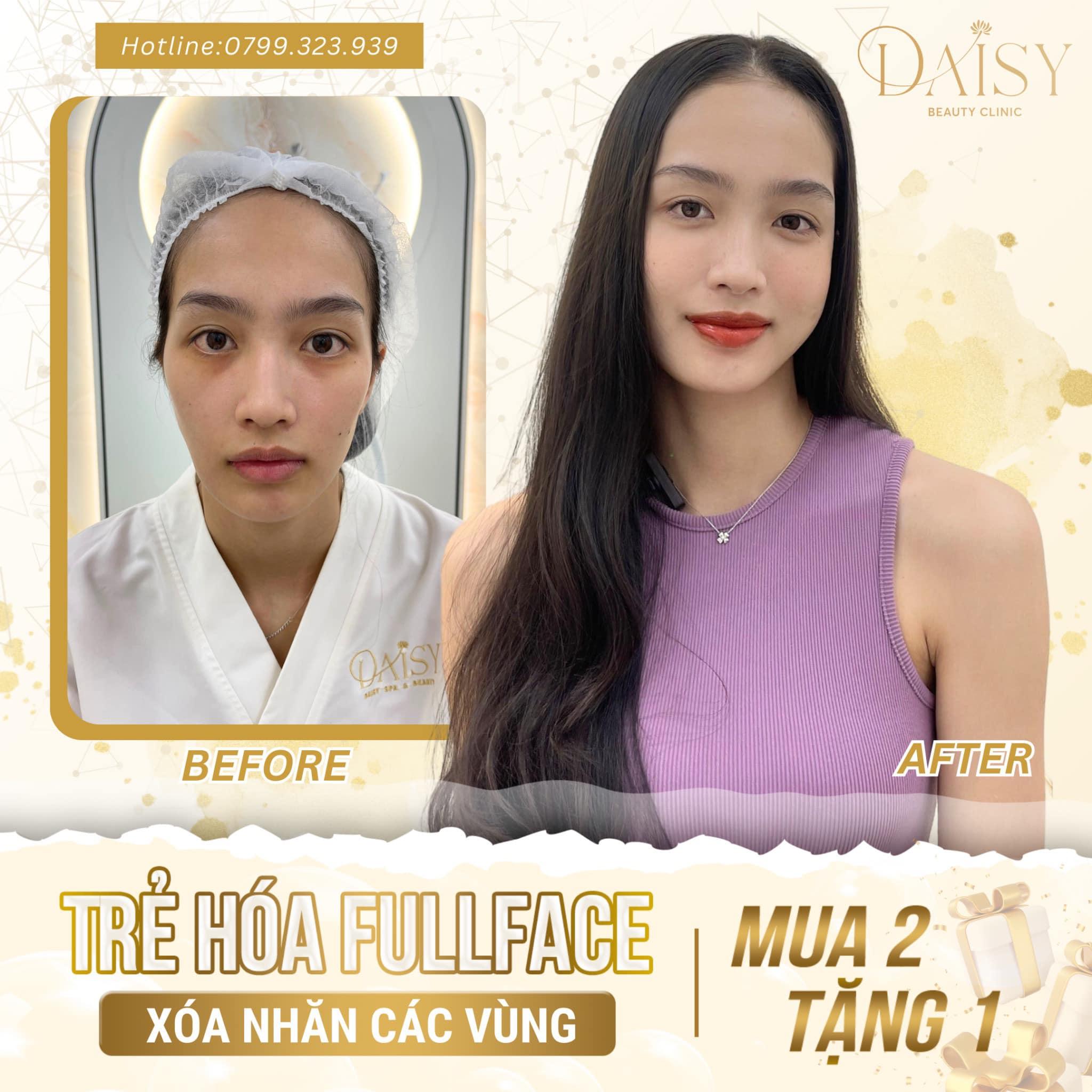 Top 8 Thẩm mỹ viện chất lượng và đáng trải nghiệm nhất tại Huế