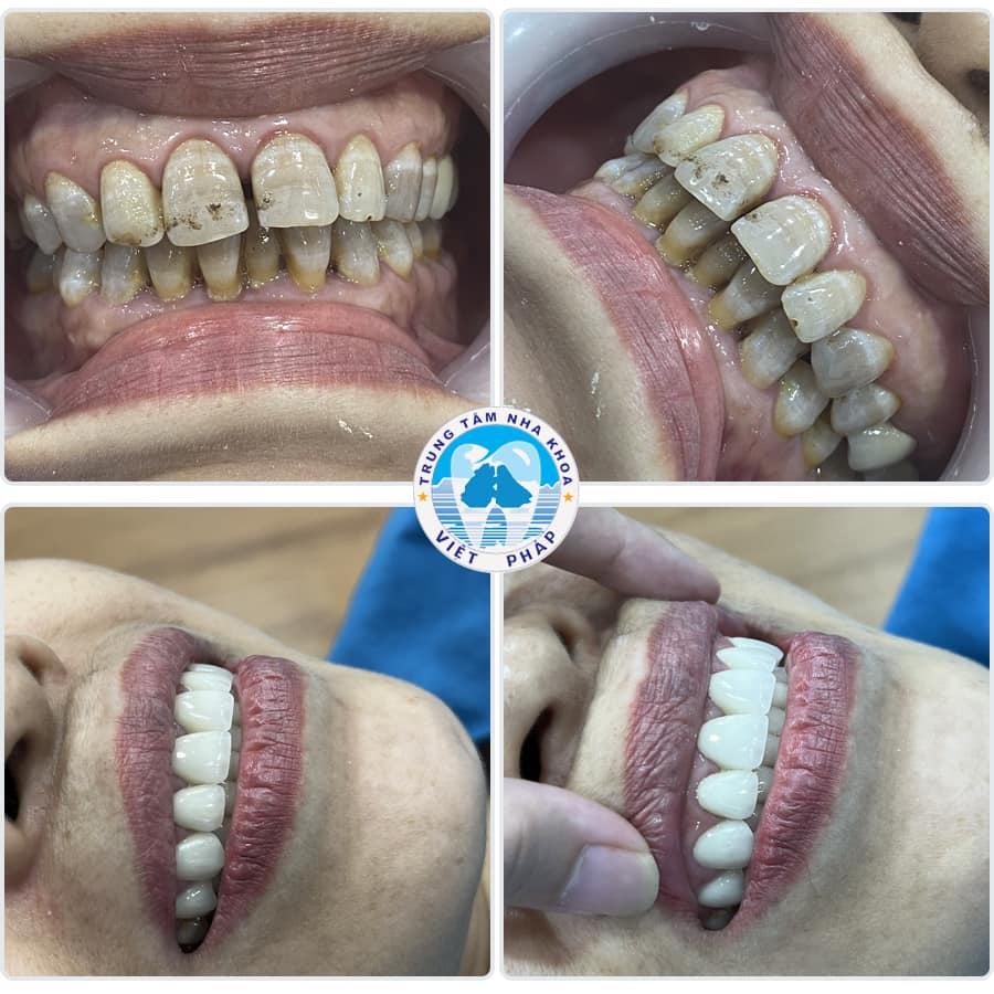 6 Phòng khám nha khoa chất lượng và đáng tin cậy nhất tại Hạ Long, Quảng Ninh
