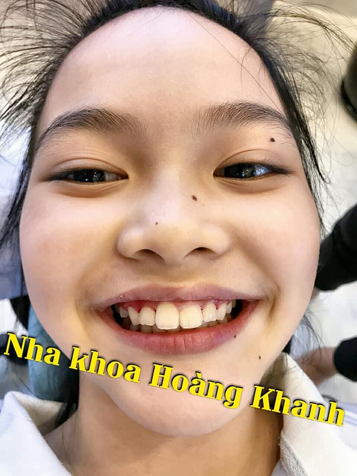 Top 6 Phòng Khám Nha Khoa Uy Tín Nhất Nam Định