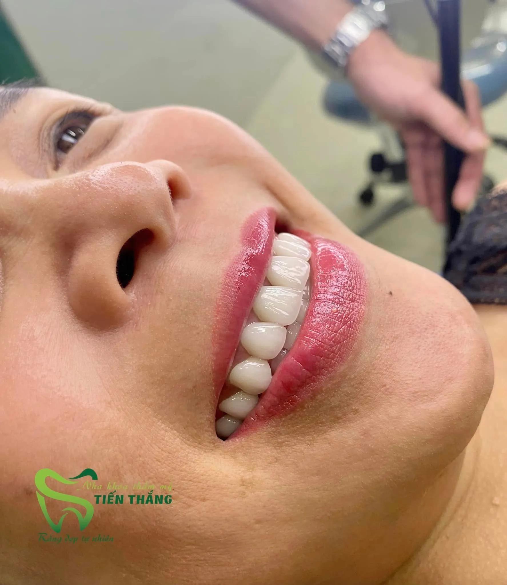 6 Phòng khám nha khoa hàng đầu tại Yên Thành, Nghệ An