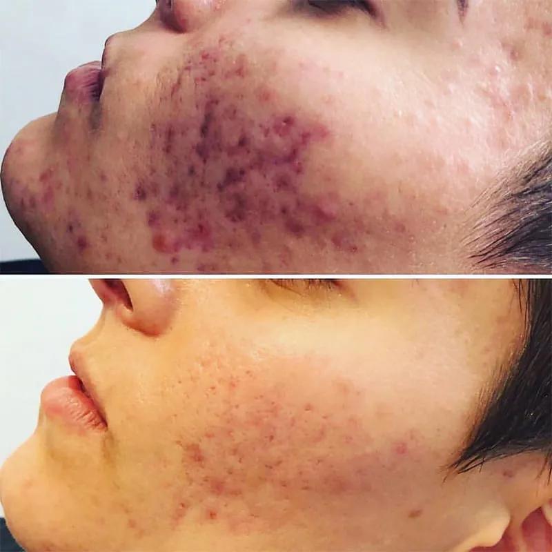 Top 4 địa chỉ phòng khám da liễu chất lượng và đáng tin cậy nhất tỉnh Quảng Nam