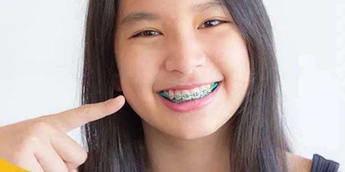Khám phá 4 địa chỉ niềng răng chất lượng và đáng tin cậy nhất tại Bến Tre