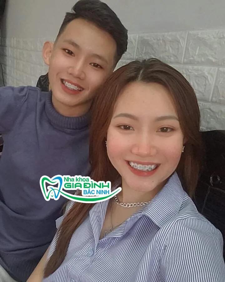 Top 8 địa chỉ niềng răng chất lượng và đáng tin cậy hàng đầu tại Bắc Ninh