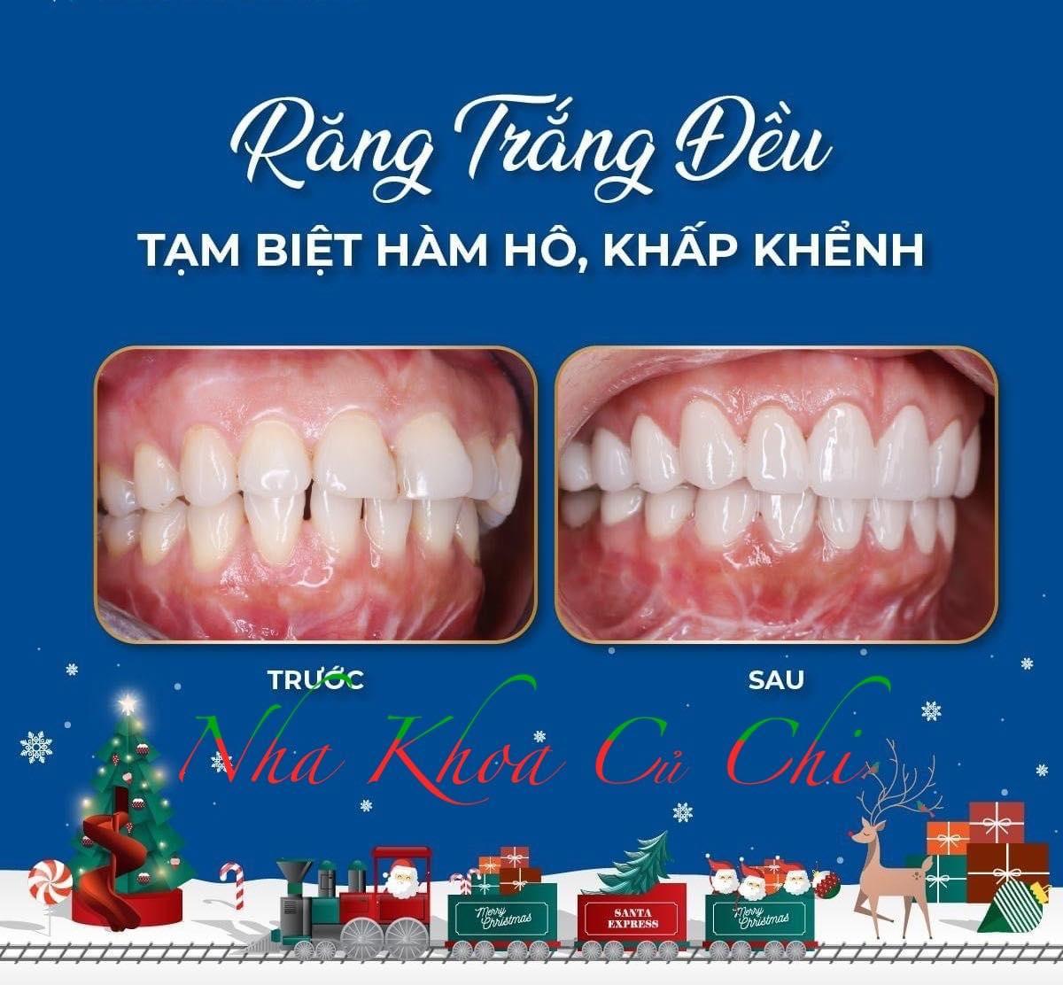 Top 4 địa chỉ nha khoa đáng tin cậy nhất tại huyện Củ Chi, TP Hồ Chí Minh