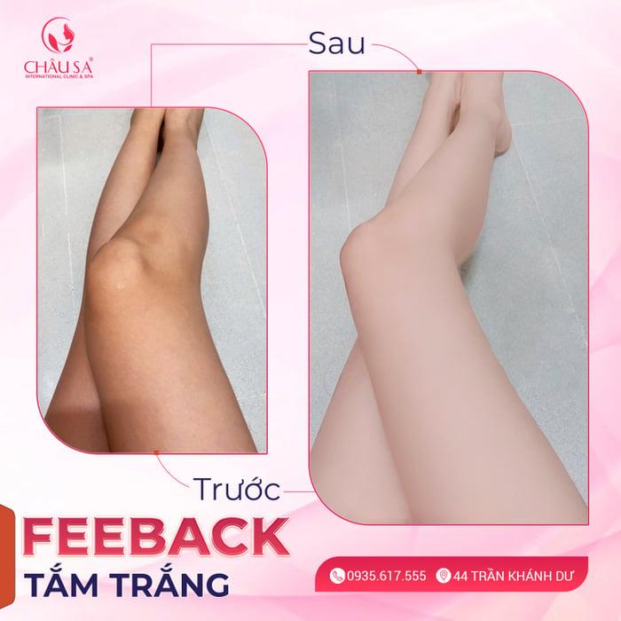 Top 6 Spa Tắm Trắng Hiệu Quả Nhất TP. Pleiku, Gia Lai