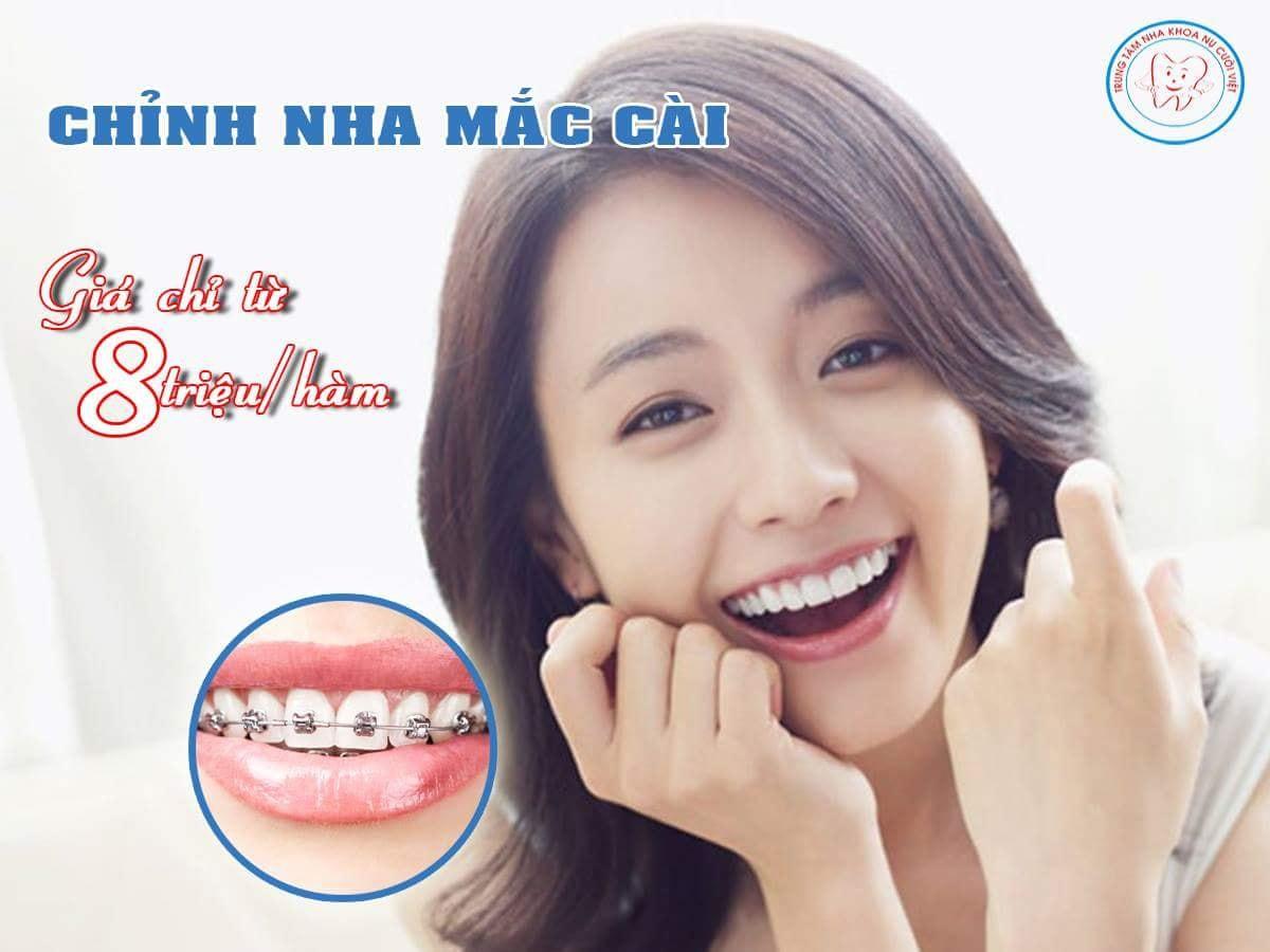 Top 5 địa chỉ niềng răng chất lượng và đáng tin cậy nhất tại Hà Tĩnh