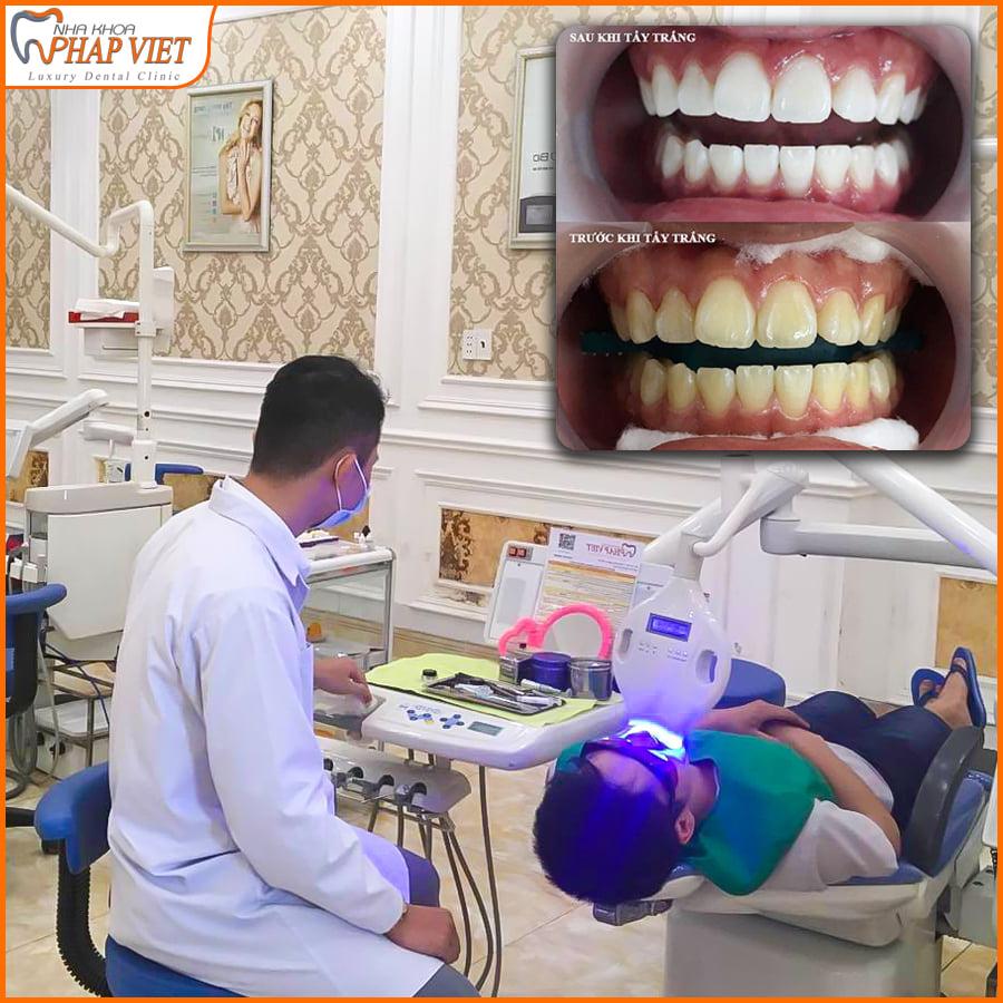 Top 5 địa chỉ phòng khám nha khoa chất lượng nhất TP. Sa Đéc, Đồng Tháp