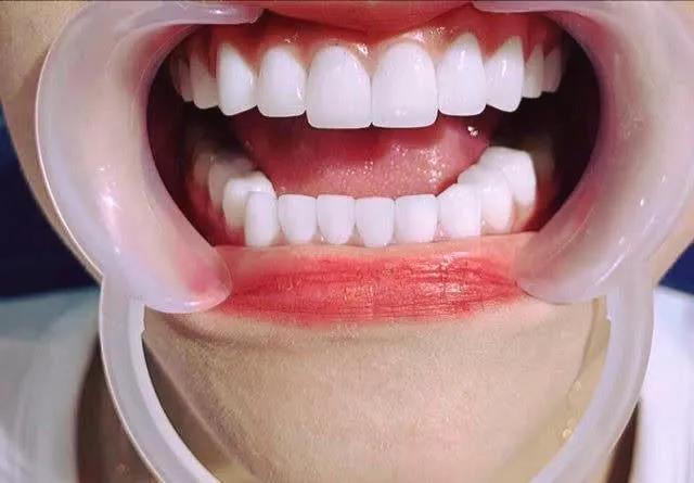 Top 7 Phòng khám nha khoa đáng tin cậy tại Quận Bình Tân, TP HCM