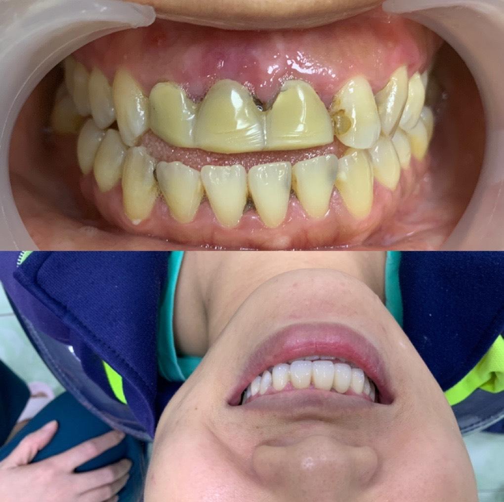 Top 6 Phòng khám nha khoa hàng đầu tại huyện Bình Chánh, TP. HCM