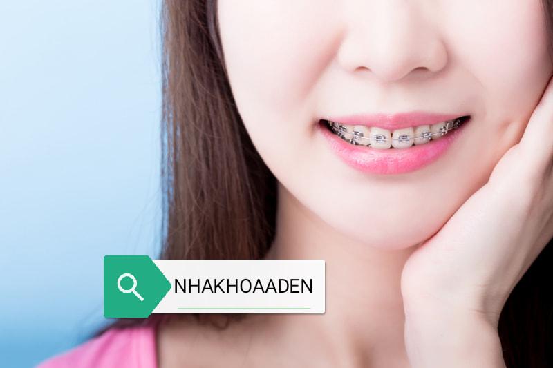 Top 4 Địa Chỉ Niềng Răng Chất Lượng & Uy Tín Hàng Đầu Quận Bình Tân, TP.HCM