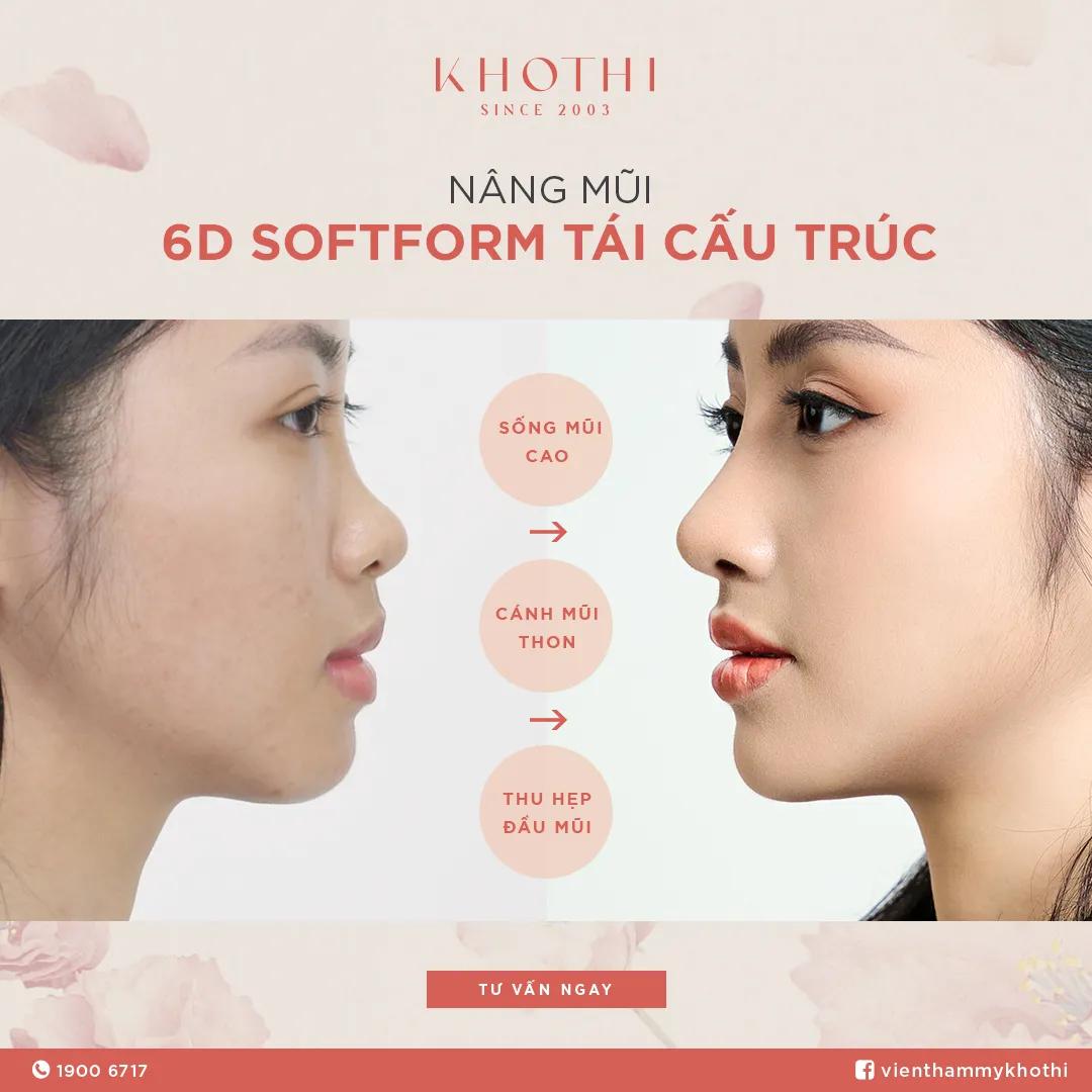 Top 5 địa chỉ nâng mũi uy tín, chất lượng nhất quận 1, TP.HCM