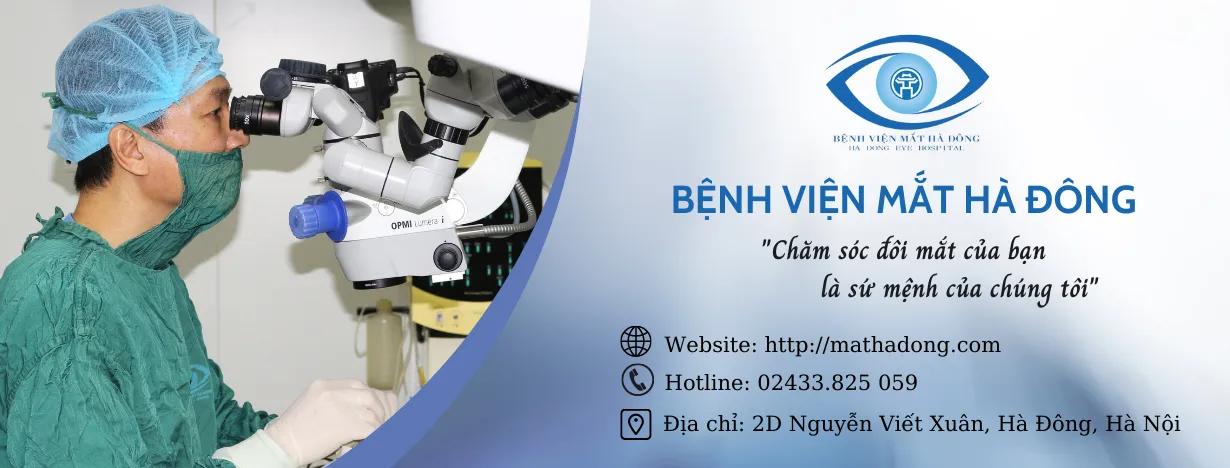 3 Địa điểm khám mắt chất lượng hàng đầu tại Hà Đông, Hà Nội