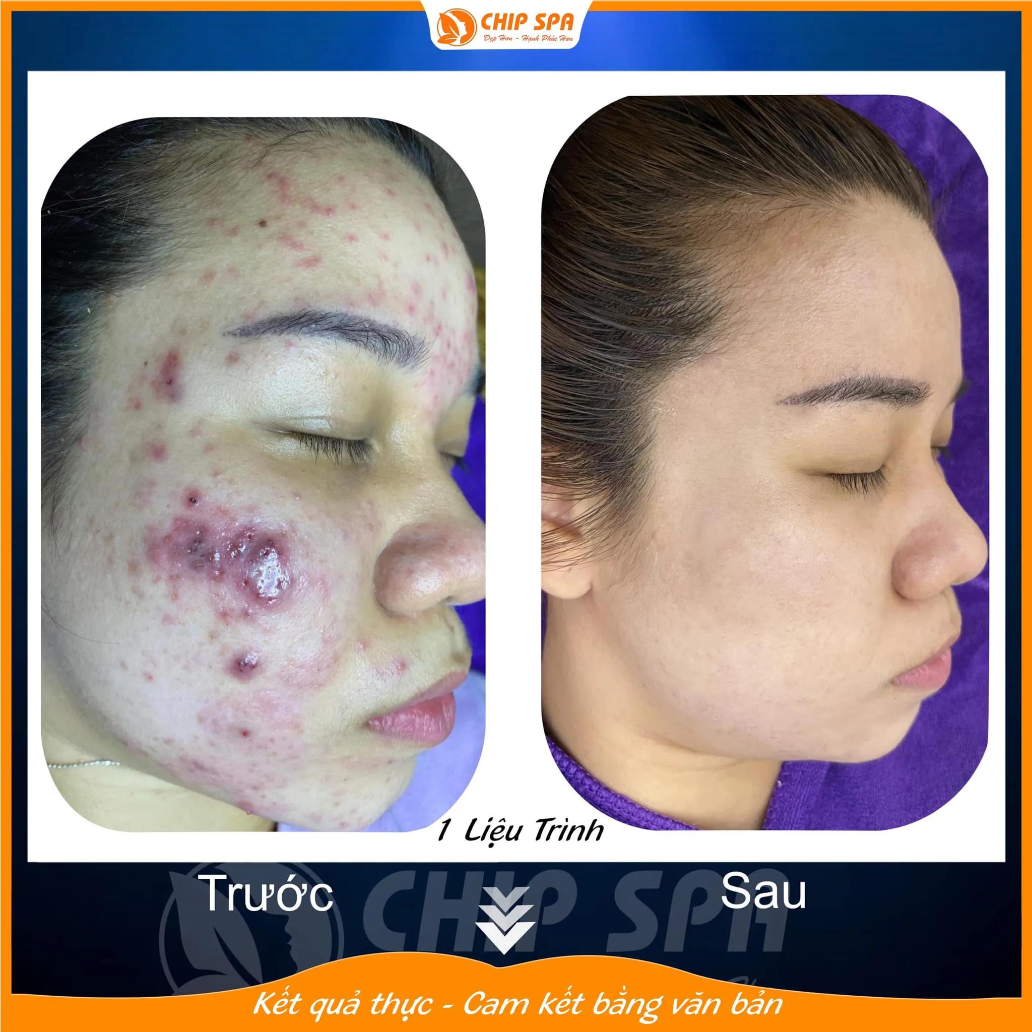 Top 10 địa chỉ Spa làm đẹp đáng tin cậy và chất lượng bậc nhất tại TP. Biên Hòa, Đồng Nai