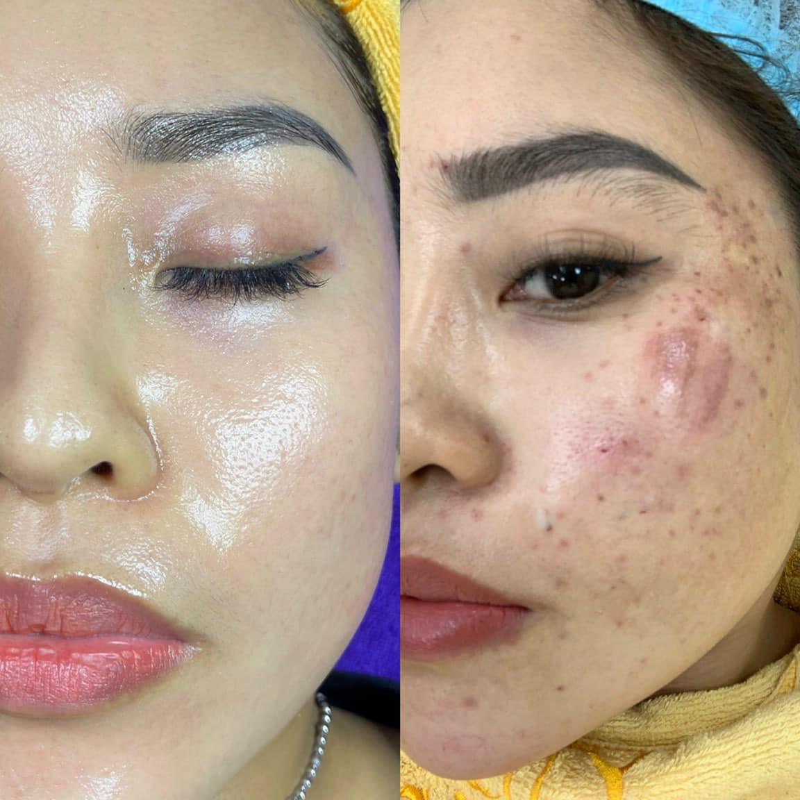 Top 5 địa chỉ spa làm đẹp đáng trải nghiệm nhất tại TP. Tam Kỳ, Quảng Nam