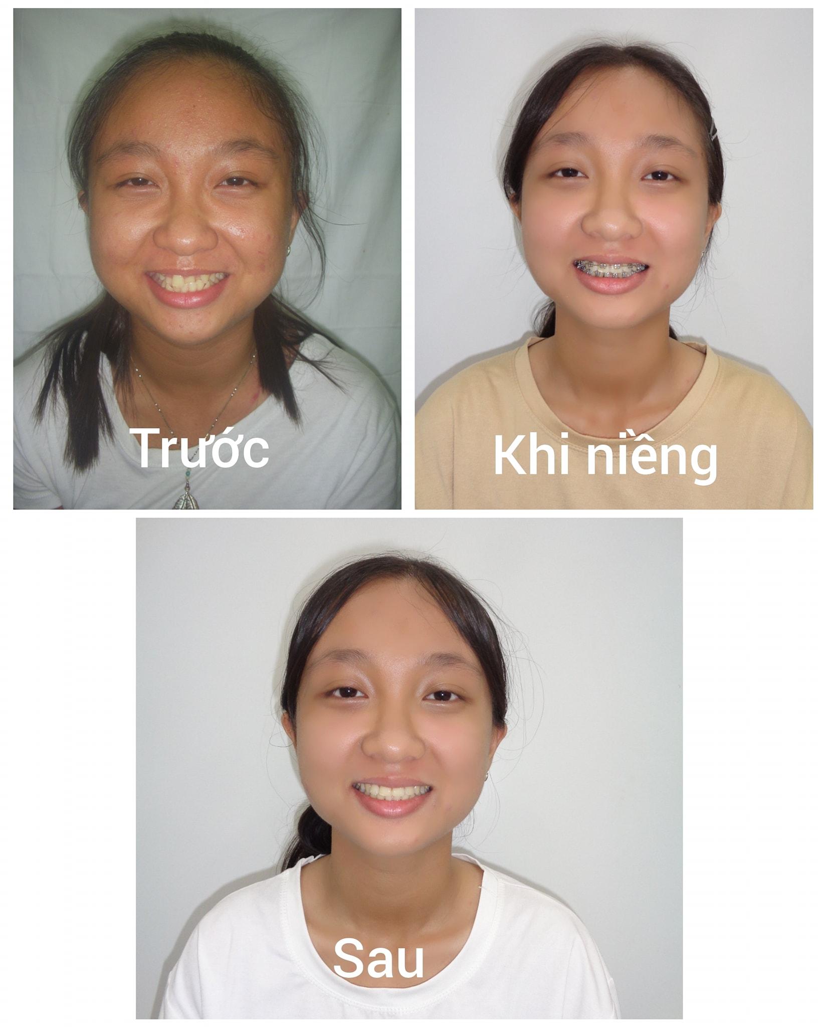 9 Địa chỉ phòng khám nha khoa đáng tin cậy hàng đầu tại Bến Tre