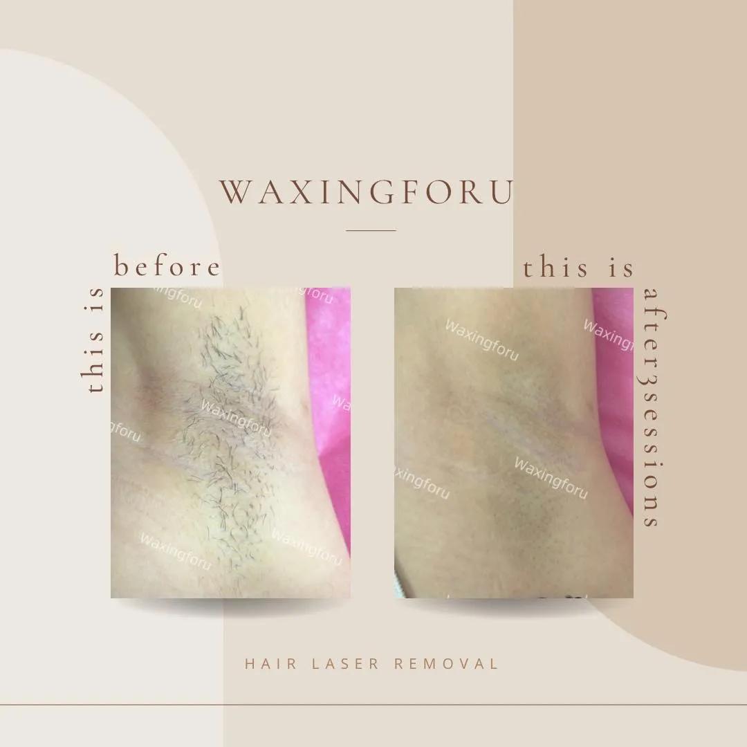5 địa chỉ wax lông chất lượng và đáng tin cậy bậc nhất tại quận 1, TP.HCM