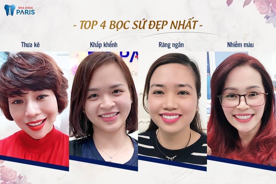 Top 5 địa chỉ bọc răng sứ uy tín và đẹp nhất tại Đà Nẵng