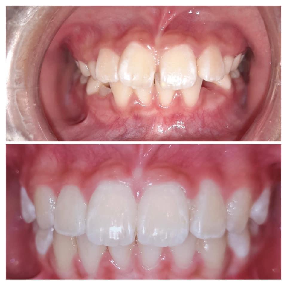 Top 5 địa chỉ phòng khám nha khoa đáng tin cậy hàng đầu tại quận 8, TP.HCM