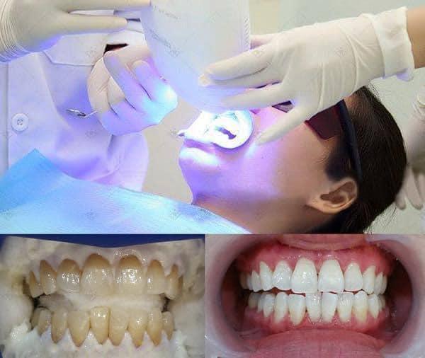 Top 8 địa chỉ phòng khám nha khoa đáng tin cậy và chất lượng nhất tại Lạng Sơn