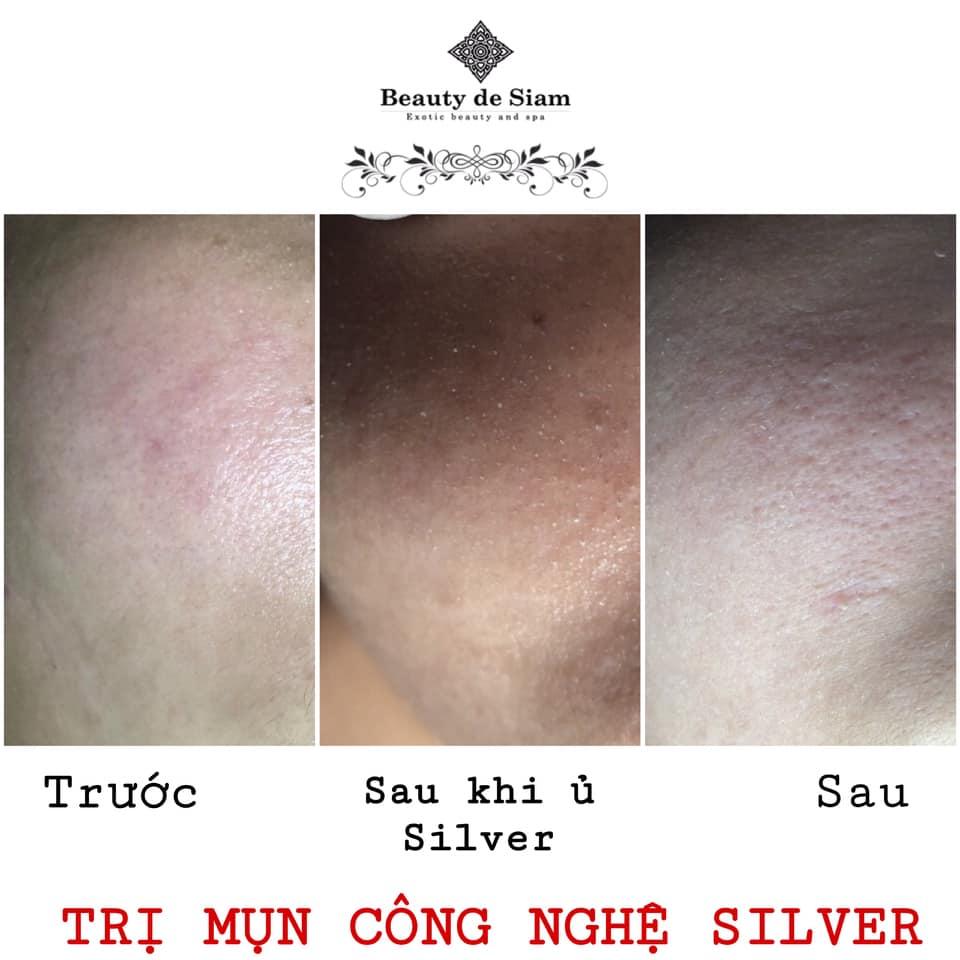 8 Địa chỉ spa trị mụn chất lượng nhất tại Mỹ Tho, Tiền Giang