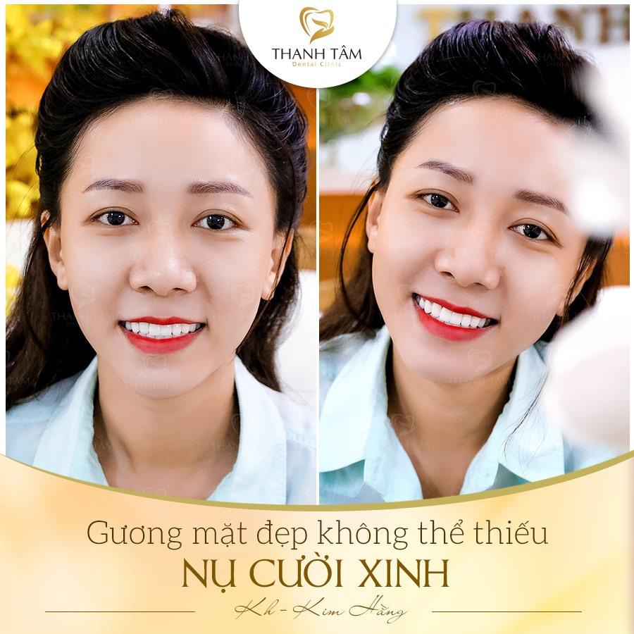 6 địa chỉ nha khoa đáng tin cậy nhất tại quận Tân Phú, TP.HCM