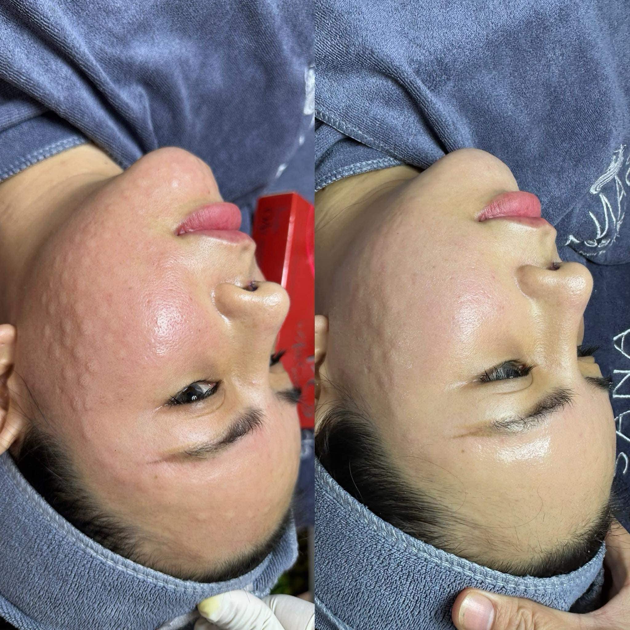 Top 5 địa chỉ spa và thẩm mỹ viện chất lượng nhất tại huyện Tri Tôn, An Giang