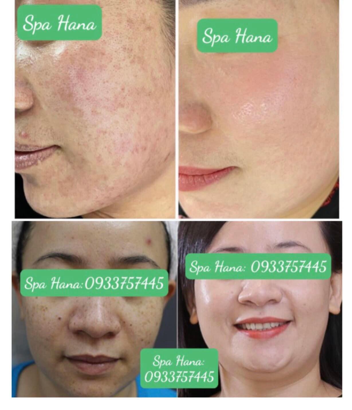 Top 4 Spa làm đẹp uy tín và nổi bật tại huyện Đất Đỏ, tỉnh Bà Rịa - Vũng Tàu