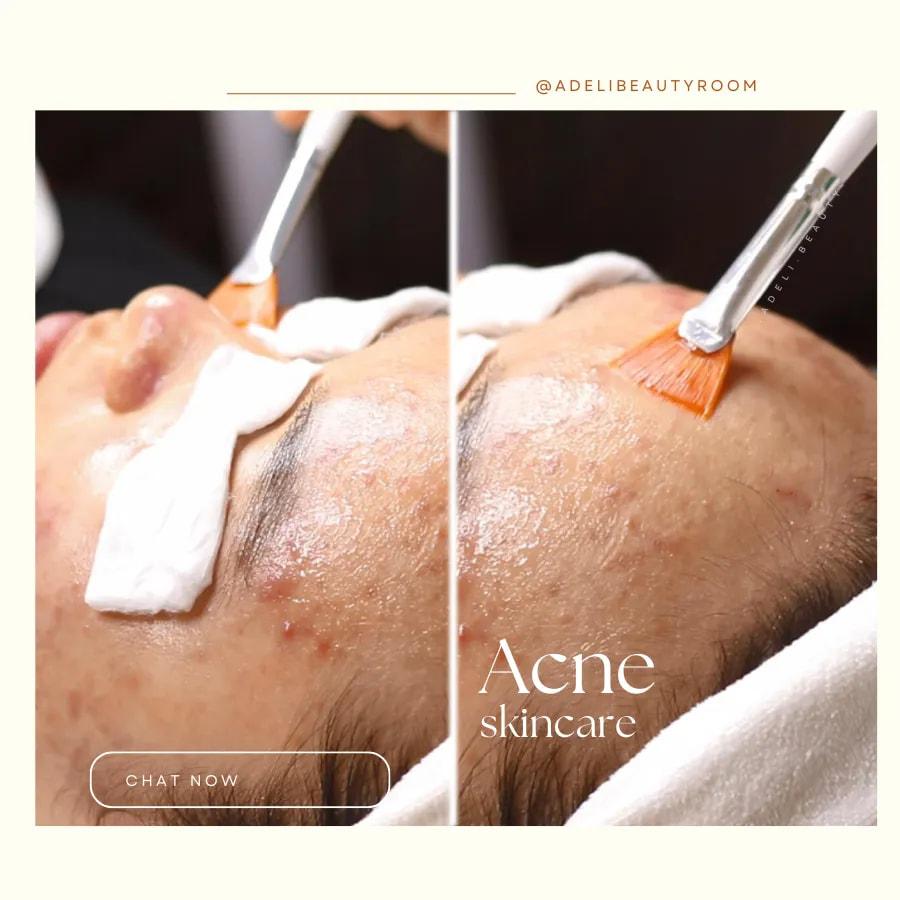 4 địa chỉ spa làm đẹp chất lượng và đáng tin cậy bậc nhất tại Đức Trọng, Lâm Đồng