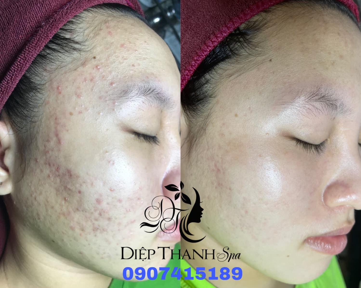 7 địa chỉ spa làm đẹp chất lượng và uy tín bậc nhất tại huyện Cờ Đỏ, Cần Thơ