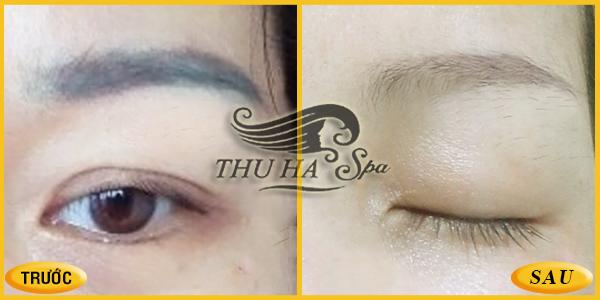 Top 5 địa chỉ xóa xăm lông mày uy tín và chất lượng nhất tại Thanh Hóa