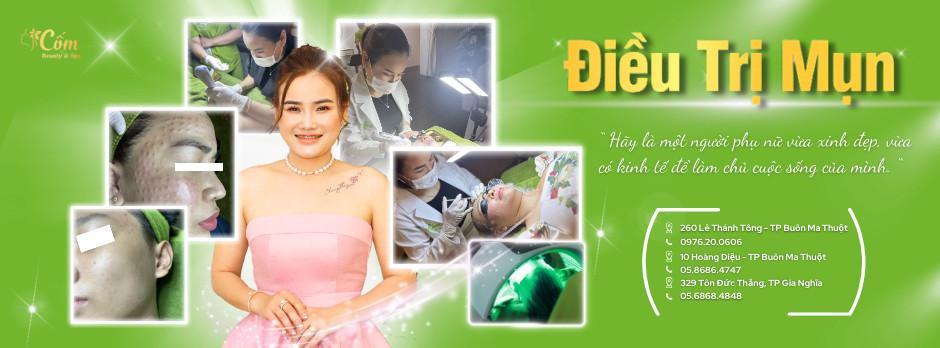 Top 10 Spa điều trị mụn hiệu quả tại TP. Buôn Ma Thuột