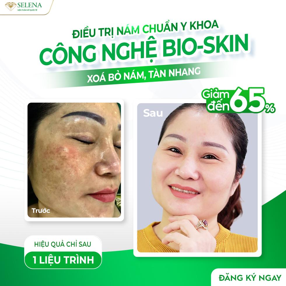 6 Địa điểm trị nám, tàn nhang, đồi mồi hiệu quả bậc nhất tại Vũng Tàu