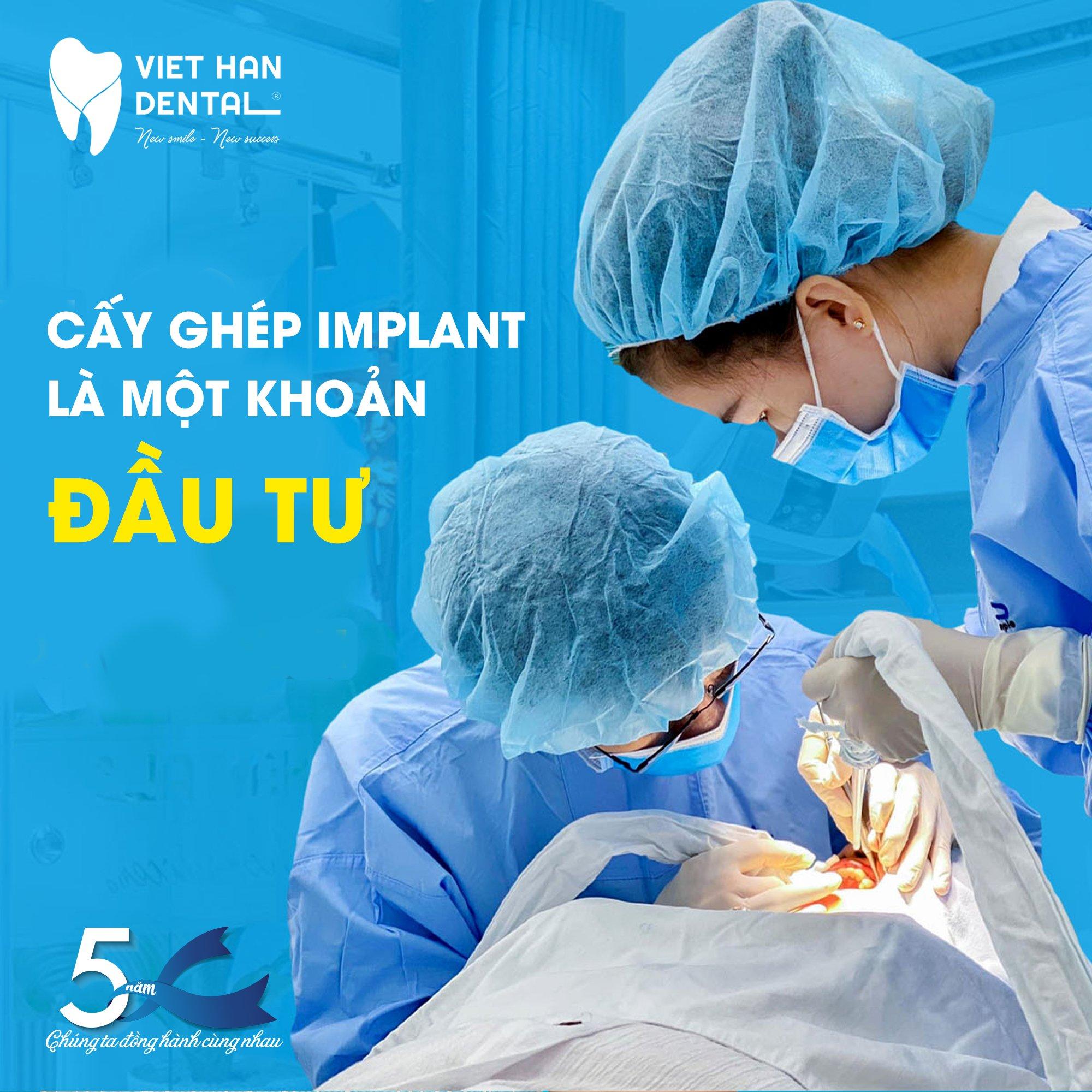 8 địa điểm trồng răng implant đáng tin cậy và chất lượng hàng đầu tại Nha Trang