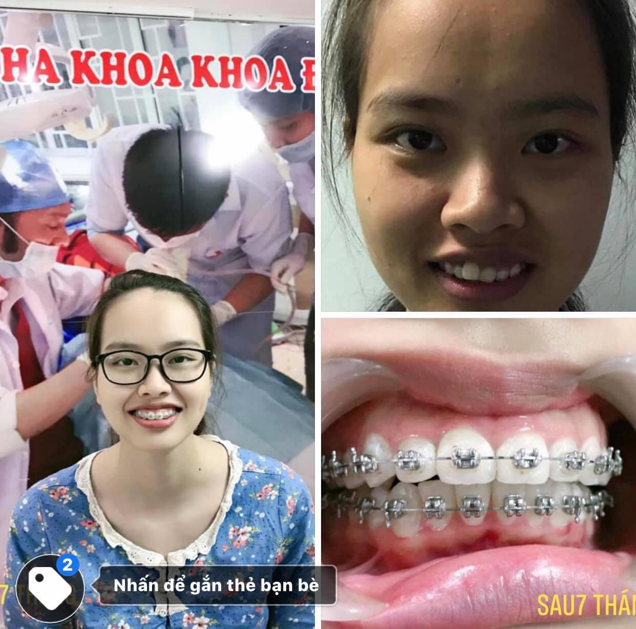 7 Địa chỉ phòng khám nha khoa đáng tin cậy hàng đầu tại Ninh Bình