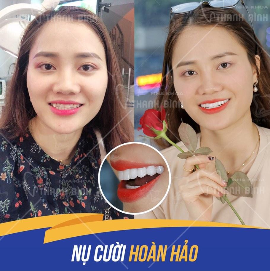 Top 9 Địa Chỉ Nha Khoa Chất Lượng Nhất Tại Đắk Nông